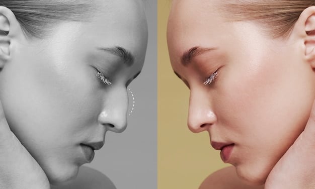 A split image showing a before-and-after comparison of a person's skin, highlighting the reduction in pore size and improvement in skin texture over a 30-day period.