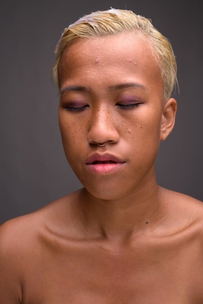 A close-up of a person's face highlighting different types of acne: blackheads, whiteheads, and cystic acne. The image is well-lit and detailed, showing the texture and appearance of each type.