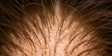 Close-up of a healthy scalp with strong, shiny hair for optimal growth